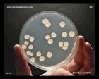 bacillus subtilis on agar